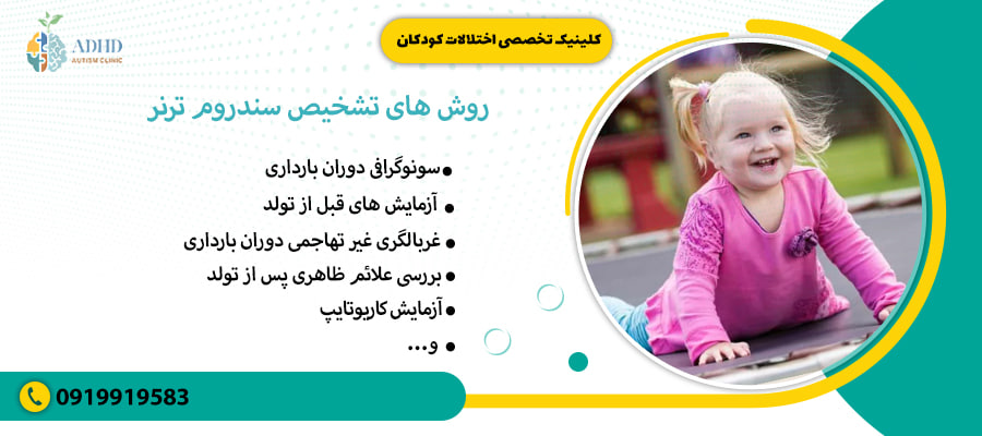 &nbsp;روش های تشخیص سندروم ترنر